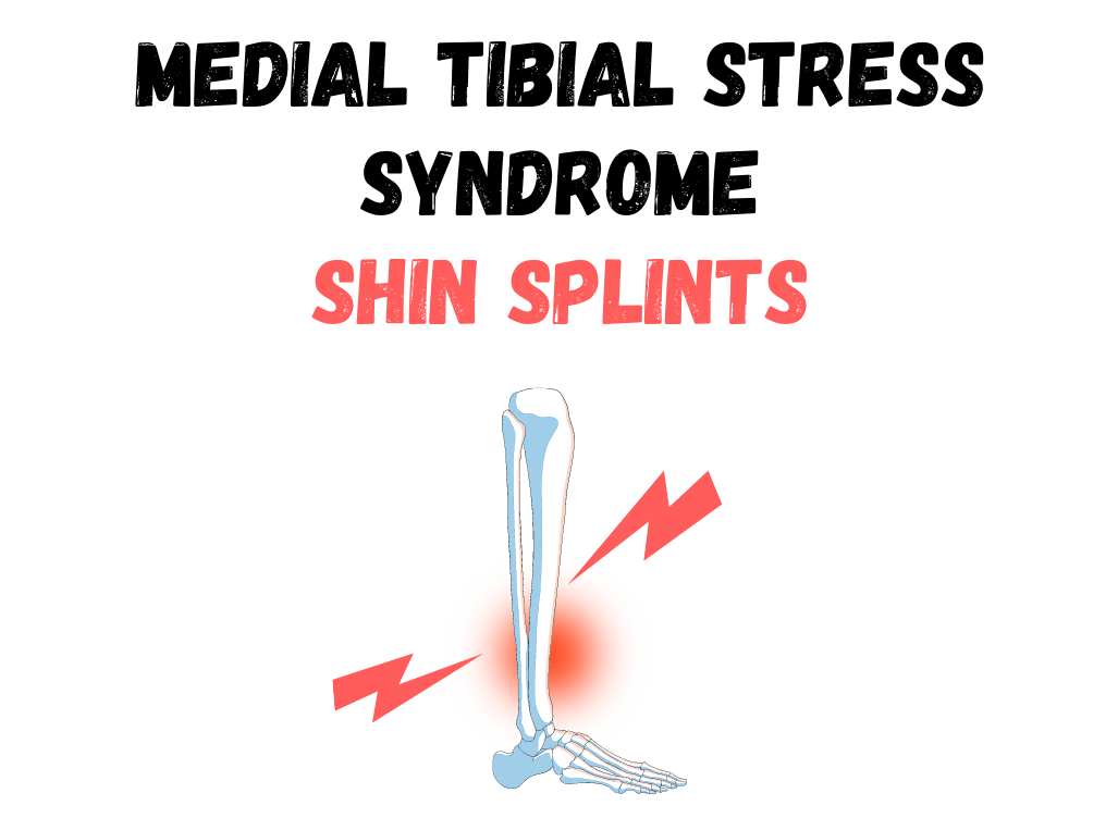 treatment for shin splint pain