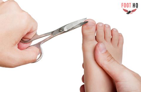 Do I have an Ingrown Toenail?